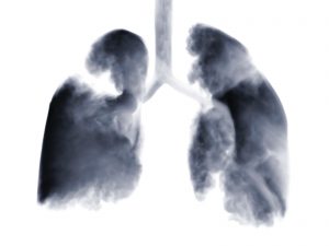 Smoke shaped as human lungs.